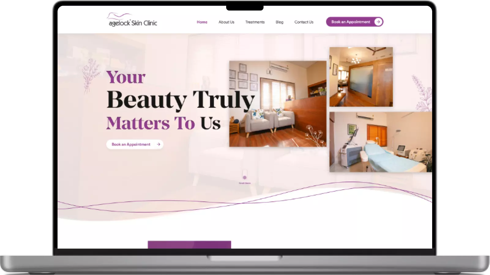 Agelock Case Study